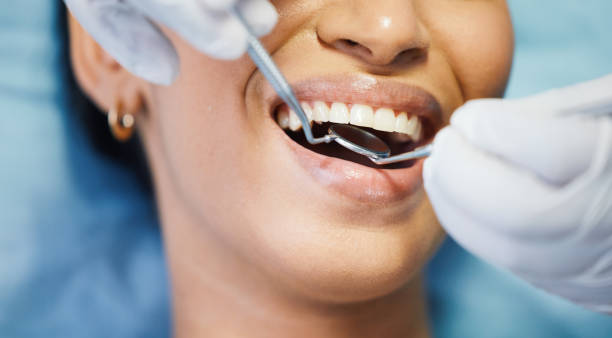Best Emergency Treatment for Dental Infections or Abscesses in Oak Grove, KY