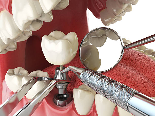 Best Emergency Denture Repair in Oak Grove, KY